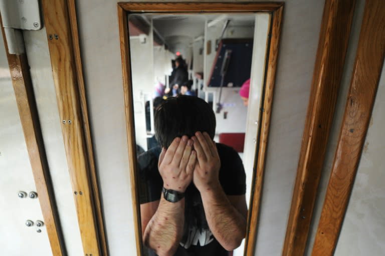 A Chechen man shows the scars on his arms as a commuter train carrying fellow asylum seekers returns to the Belarusian city of Brest after a failed attempt to enter Poland on December 21, 2016