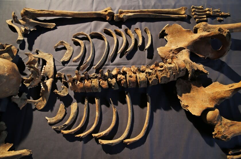 In this Wednesday, March 26, 2014 photo, one of the skeletons found by construction workers under central London's Charterhouse Square is pictured. Twenty-five skeletons were uncovered last year during work on Crossrail, a new rail line that's boring 13 miles (21 kilometers) of tunnels under the heart of the city. Archaeologists immediately suspected the bones came from a cemetery for victims of the bubonic plague that ravaged Europe in the 14th century. The Black Death, as the plague was called, is thought to have killed at least 75 million people, including more than half of Britain's population. (AP Photo/Lefteris Pitarakis)