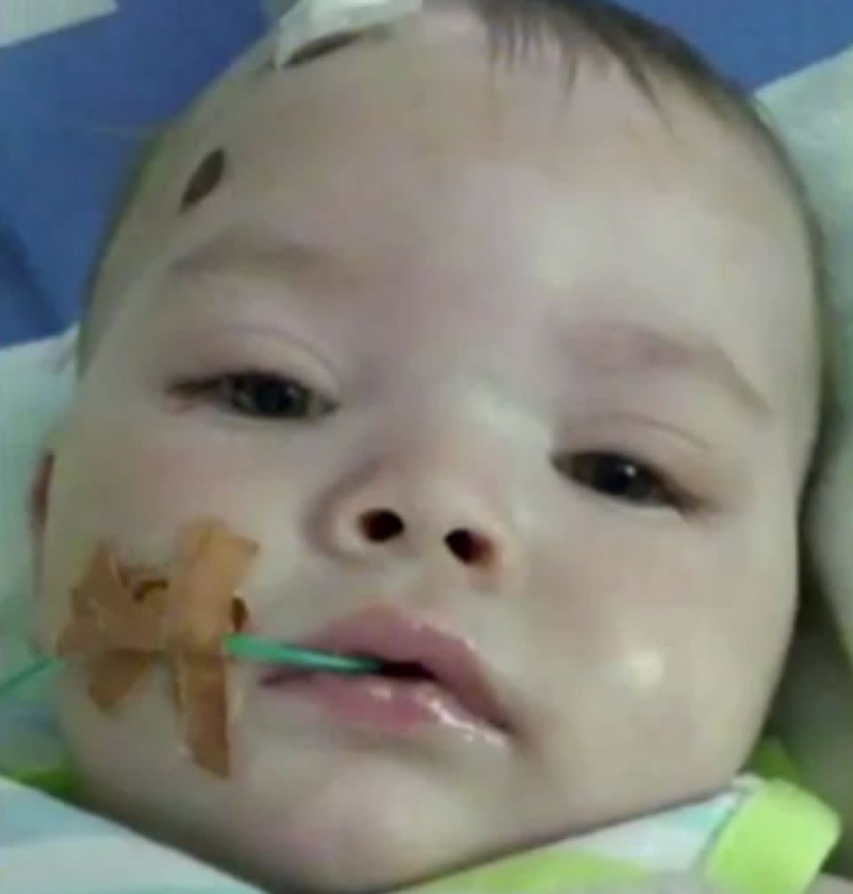 Bobby Webber was left with horrific lifelong injuries when he was just seven months old. Photo: 7 News