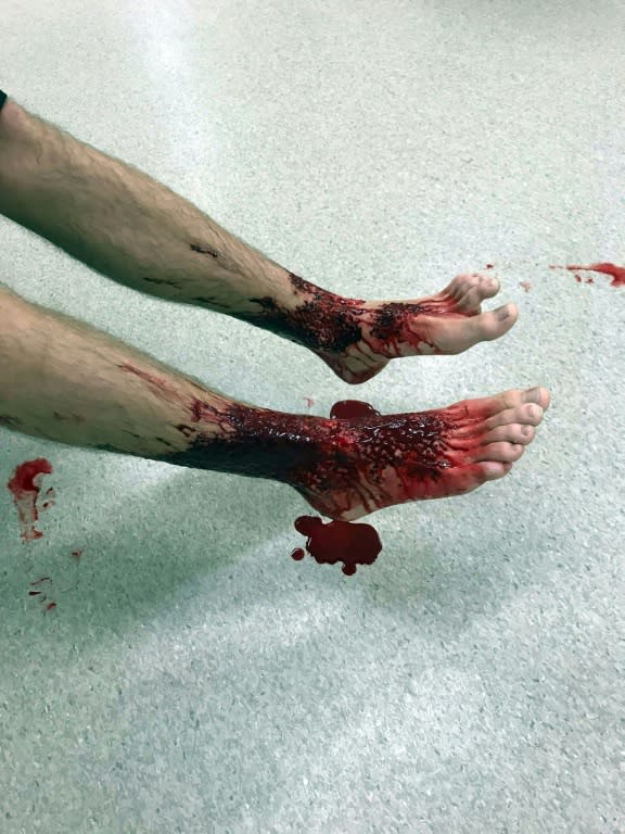 <em>The teenager emerged from a night-time dip in the ocean with blood streaming from his feet (AFP)</em>