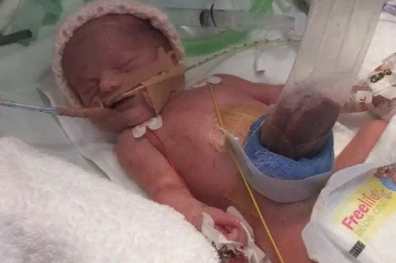 Lucy had to battle for five weeks in the neonatal unit