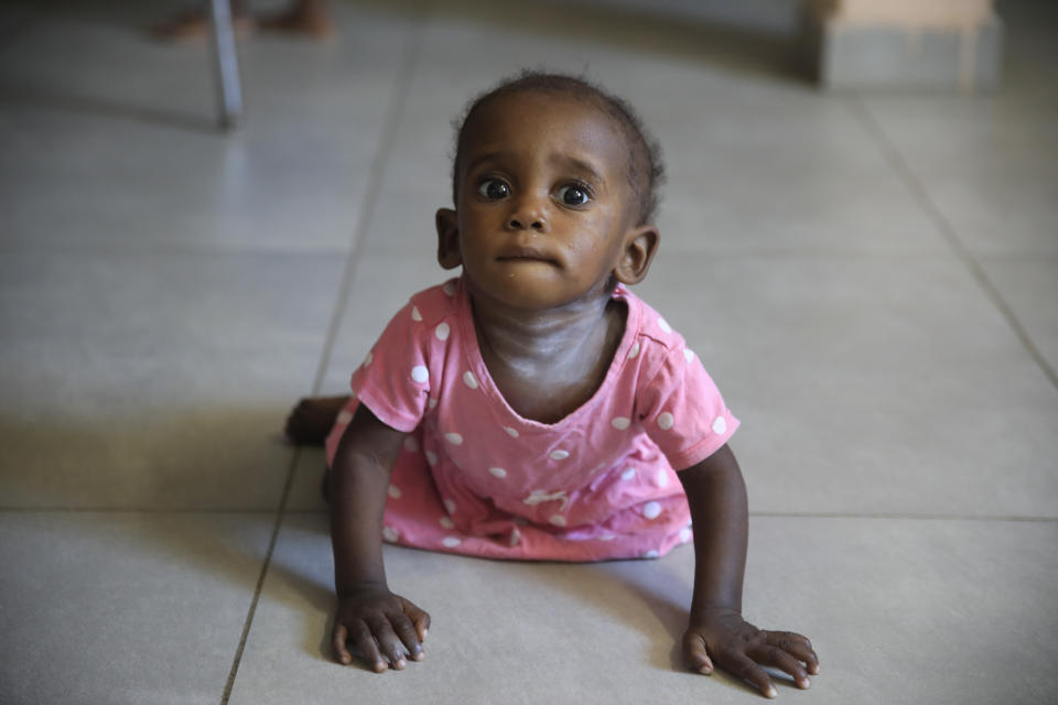 A child crawls in the malnutrition stabilization center of Fontaine Hospital Center in the Cité Soleil area of Port-au-Prince, Haiti, Monday, Jan. 23, 2023. As gangs tighten their grip on Haiti, many medical facilities in the Caribbean nation's most violent areas have closed, leaving Fontaine as one of the last hospitals and social institutions in one of the world's most lawless places. (AP Photo/Odelyn Joseph)