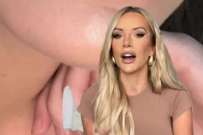 Faye Winter opened up about her lip filler journey, sharing how she went too big at one point