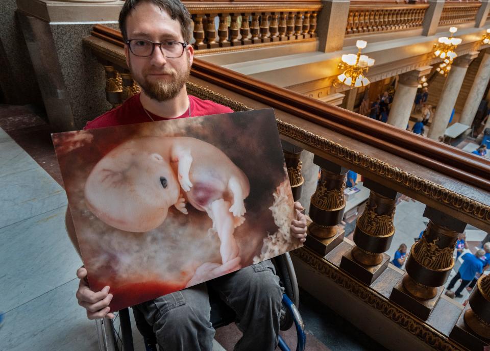 Zach Smith holds a fetus image after the Love them Both Rally hosted by Right to Life Indiana at the Indiana Statehouse, Tuesday, July 26, 2022 in Indianapolis, Ind.  Indiana legislature are in a special session to discuss abortion law.