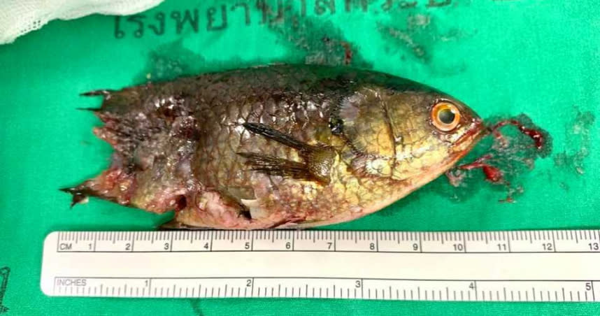 泰國一名漁夫釣到1條約10公分長的魚，便先將牠叼在嘴裡，魚兒竟直接竄入漁夫的喉嚨內，卡在喉嚨拔不出來。（圖／FB）