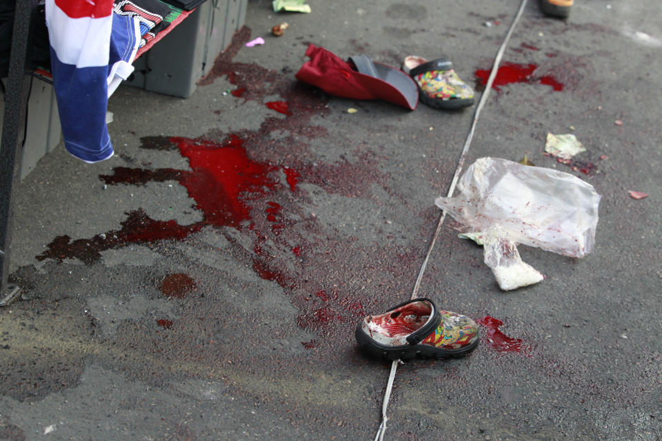 Puddles of blood and small pairs of shoes are seen at the site of an explosion at a main protest site in Bangkok, Thailand, Sunday, Feb. 23, 2014. More than a dozen people were hurt Sunday by a small explosion at an anti-government protest in Bangkok, less than a day after a bloodier attack in an eastern province killed one child and left about three dozen people wounded. (AP Photo/Wally Santana)