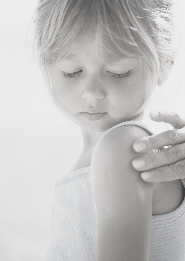 Some schools and camps prohibit teachers and camp counselors from applying sunscreen on kids, leaving children vulnerable to sunburn. (Photo: Alamy)