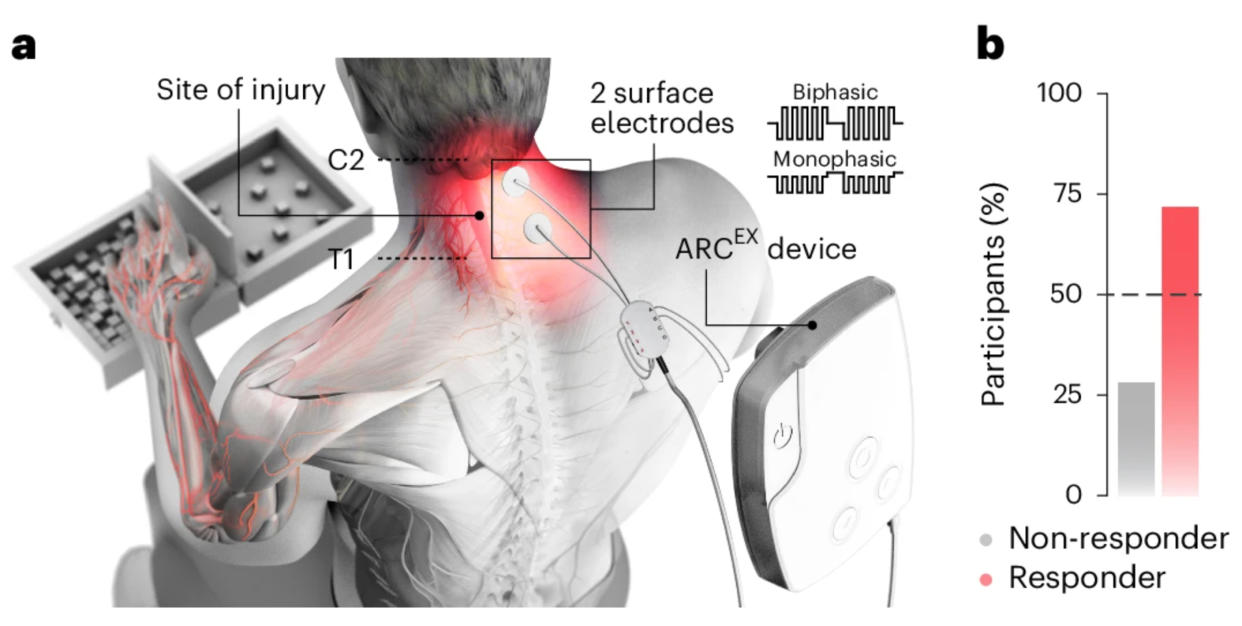 ARC-EX Therapy