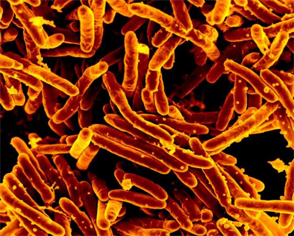 Scanning electron micrograph of Mycobacterium tuberculosis, the bacteria that cause tuberculosis.