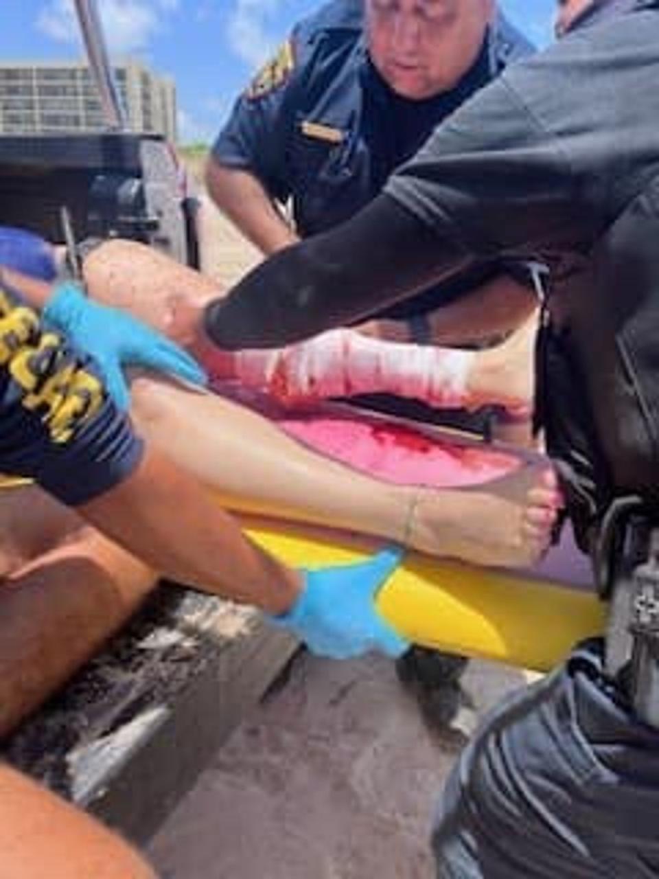 Two off-duty agents from Border Patrol Laredo Sector rendered aid to a shark attack victim on South Padre Beach (US Border Patrol Laredo Sector)