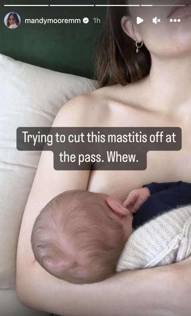 Mandy Moore breastfeeding her son with the caption trying to cut this mastitis off at the pass whew