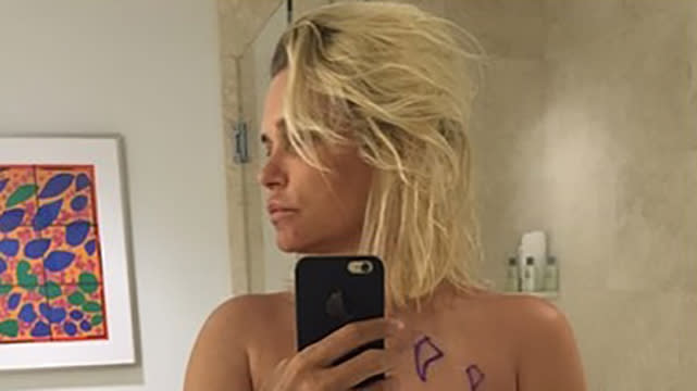 Could a rupture from a 20-year-old implant be the cause of <em>Real Housewives of Beverly Hills</em> star Yolanda Foster's chronic health issues? This could certainly be the case according to Yolanda herself, as she Instagrammed an important discovery on Friday regarding her health. "Turn a mess into a message....... We might have hit the jackpot by finding all this silicone from a 20 year old implant rupture through ultrasound mapping as shown in this selfie," she wrote. "Thank you Dr.Feng for holding my hand and leading the way #UncoveringTheMystery #ChronicLymeDisease #ExPlantSurgery @FengClinic #MyHealthJourney #DeterminedToFindACure." <strong>WATCH: Yolanda Foster Has Lost the Ability to Read or Write</strong> One week ago, Yolanda also Instagrammed a picture of herself reading Dr. Susan E. Kolb's book, <em>The Naked Truth About Breast Implants: From Harm to Healing</em>. The book discusses silicone, chemical, and biotoxicity problems caused by breast implants. The 51-year-old reality star was diagnosed with Lyme disease in 2012, and has been open about her health struggles with her fans in the past. In January, she revealed that she's "lost the ability to read, write, or even watch TV" in a blog post for Bravotv.com. "It feels like someone came in and confiscated my brain and tied my hands behind my back to just watch and see life go by without me participating in it," she wrote. Previously, the mother-of-three had never discussed having breast implants. But she definitely hinted that she'll be removing them in her latest Instagram, hashtagging the post, "ExPlantSurgery." <strong>WATCH: Yolanda Foster Says Ongoing Battle with Lyme Disease Is a 'Nightmare'</strong> Last week, Yolanda spent time with her children -- models Gigi and Bella, as well as their brother Anwar -- sporting a matching plunging red swimsuit with 18-year-old Bella. "My loves, My life, my reason for living," she wrote about a selfie of the three of them together. Watch below: