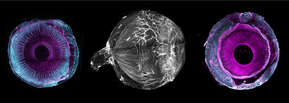 Les images de l’œil « transparisé » sont numérisées puis modélisées en 3D sur ordinateur. 