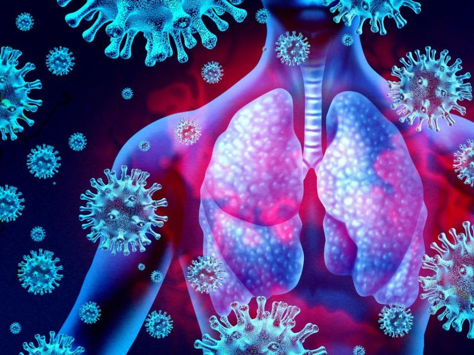 Lung Virus Infection