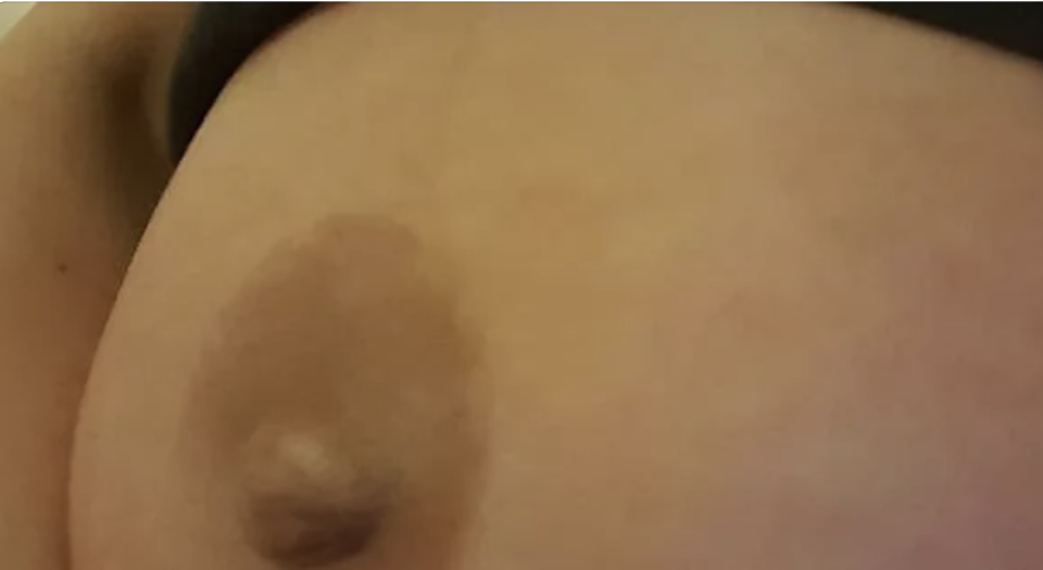 closeup of the belly that looks like a boob