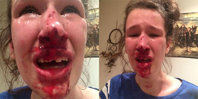 Ashlee Savins was allegedly assaulted just before 1am on Saturday. Photo: Facebook