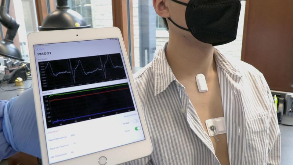 <div class="inline-image__caption"> <p>App on a tablet shows the electrocardiogram reported from the chest-mounted device.</p> </div> <div class="inline-image__credit"> Northwestern University </div>