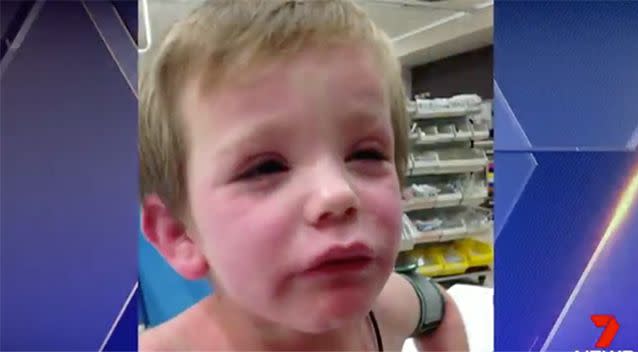 Liam was bitten by a tick. Source: 7 News