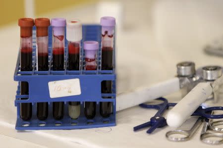 Testing tubes full of blood are seen at the American Red Cross Charles Drew Donation Center in Washington February 16, 2016. REUTERS/Gary Cameron