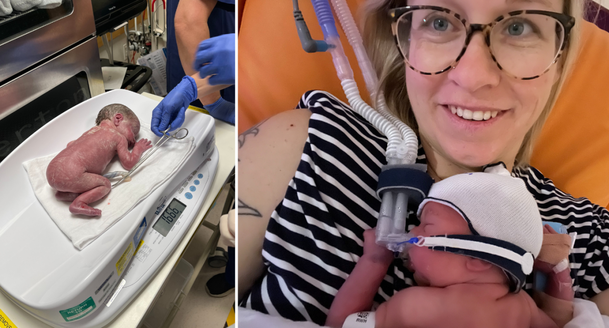 Baby Daisy in hospital (left) and Clare Slater holding Daisy (right).