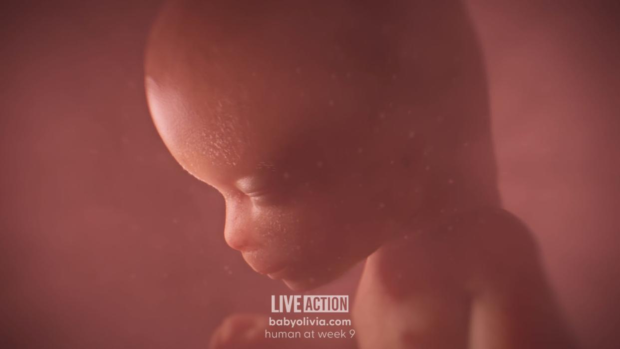 The u0022Baby Oliviau0022 video comes from the group Live Action and shows the early stages of human development. Some Kentucky lawmakers are pushing for school children to watch it.