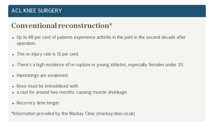 ACL conventional reconstruction