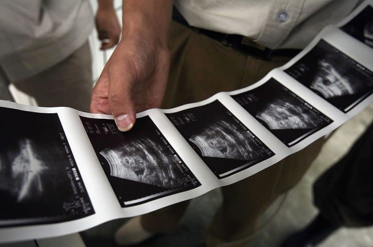 Private scan firms offer vouchers and promotions to entice mums-to-be [Photo: Getty]