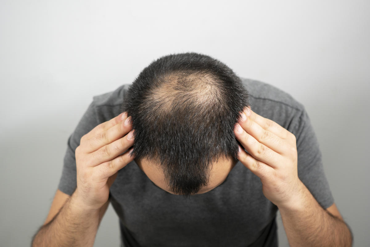 Bald ein Heilmittel gegen Haarausfall?