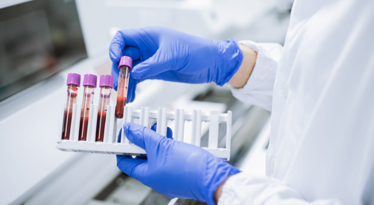 Scientist wearing gloves holding test tube in sample rack to check quality of the sample. TTOO stock