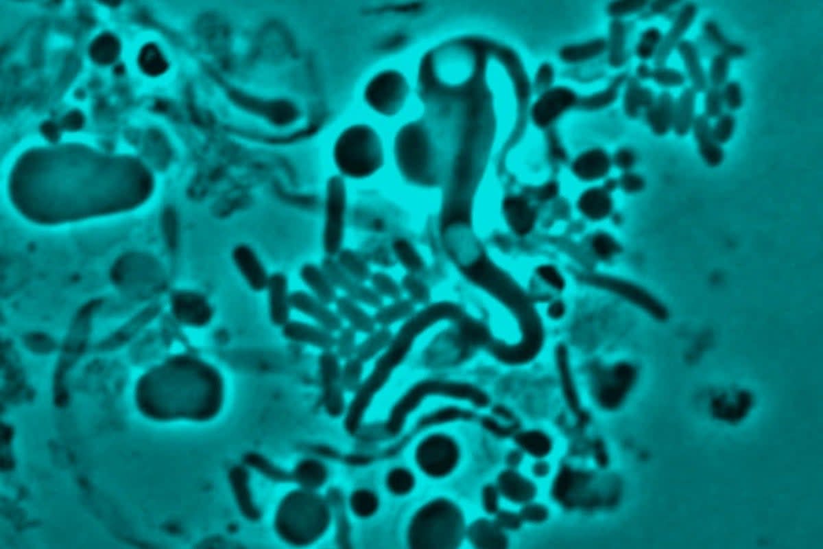 E. coli bacteria in close-up (PA)