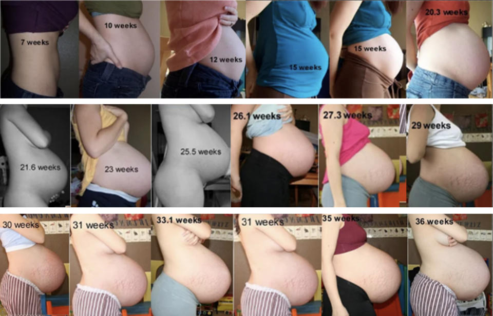 A collage of pregnancy progress, showing a person's abdomen from 10 to 36 weeks