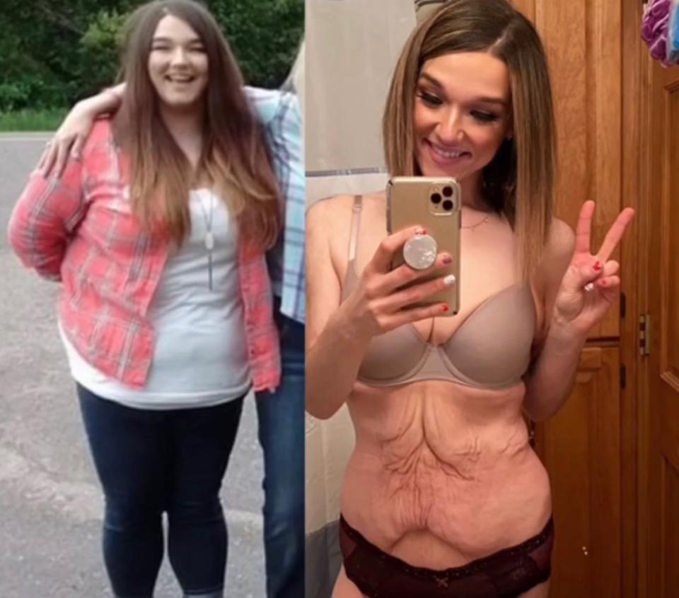 She calls weight loss the “most difficult, fulfilling, rewarding and meaningful chapter of my life.” TikTok