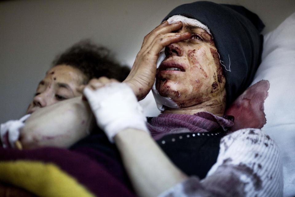 FILE - In this Saturday, March 10, 2012 file photo, Aida, 32, reacts as she recovers from severe injuries after the Syrian Army shelled her house in Idlib north Syria. Aida's husband and two of her children were killed after their home was shelled. Nearly three years after the crisis began, Syria's government and opposition are set to meet in Geneva this week for the first direct talks aimed at ending the conflict. (AP Photo/Rodrigo Abd, File)