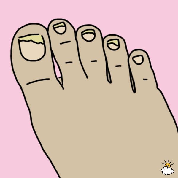 11 easy, natural ways to treat nearly all of your foot problems