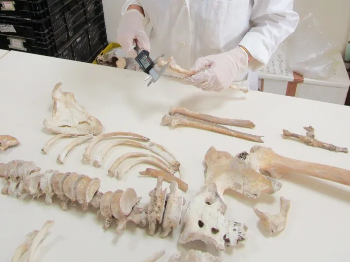 Study co-author Serena Viva examines the remains of a man who died in Pompeii's eruption.