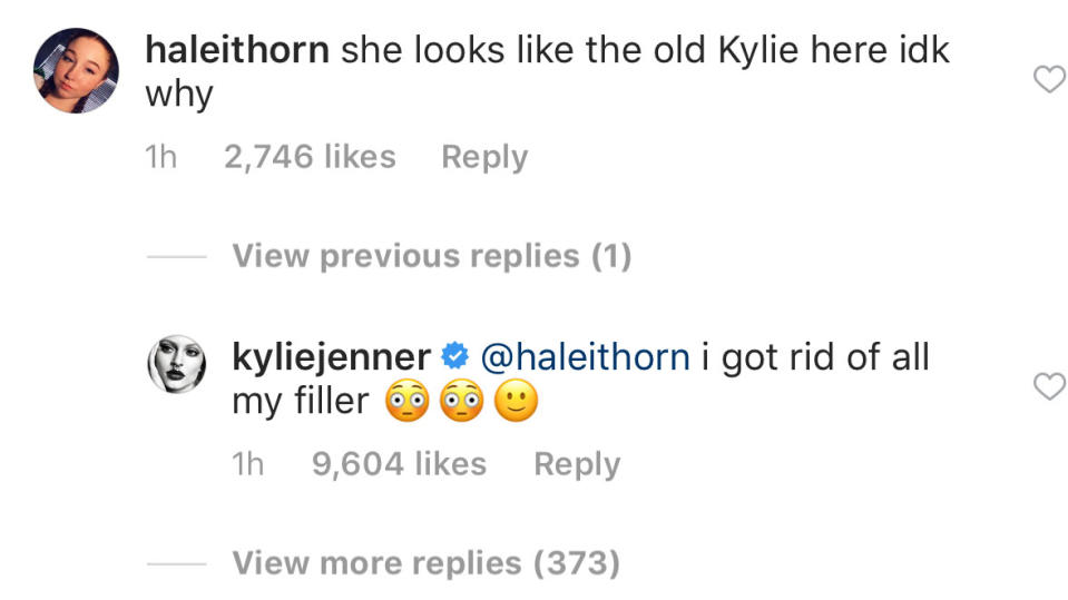 Kylie revealed she got rid of all her filler. Source: Instagram/kyliejenner