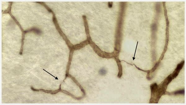 （圖為顯微鏡下腦皮質微血管血液供應不足的影像）