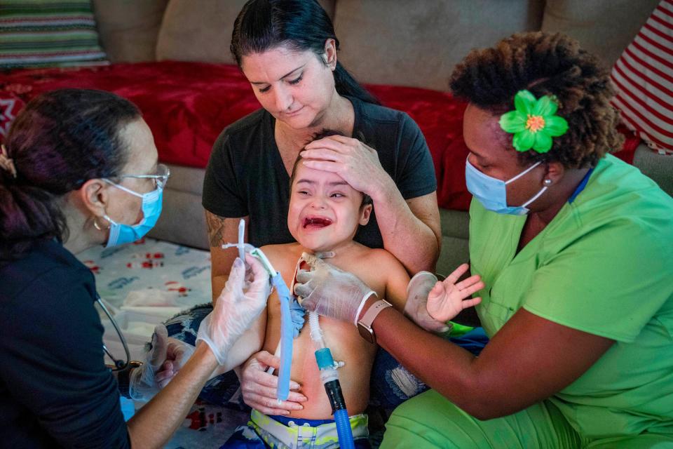 Michelle Thivierge holds her son Roman Burnette, 5, while respiratory therapist Diana Hanson, left, and LPN Ingrid Bienveu change his trac tube. Roman was born with Down syndrome and a host of medical issues.