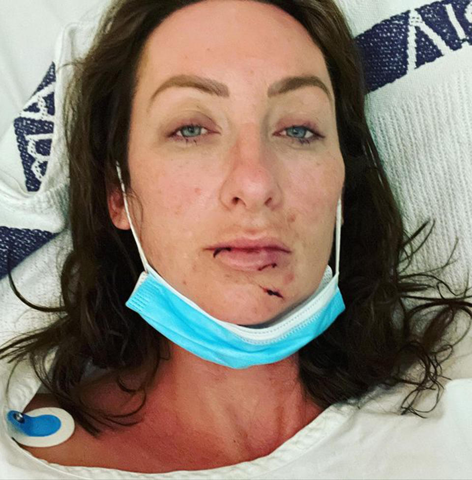 Gogglebox star Isabelle Silbery in hospital with a broken jaw. Photo: Instagram/isabellesilbery.