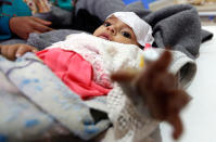 <p>A Yemeni infant suspected of being infected with cholera receives treatment at Sabaeen Hospital in Sana’a, on June 13, 2017.<br> Six weeks into the second outbreak of the deadly disease in less than a year, at least one patient checks in at Sabaeen every 60 seconds — a level of emergency that overwhelms staff. (Mohammed Huwais/AFP/Getty Images) </p>