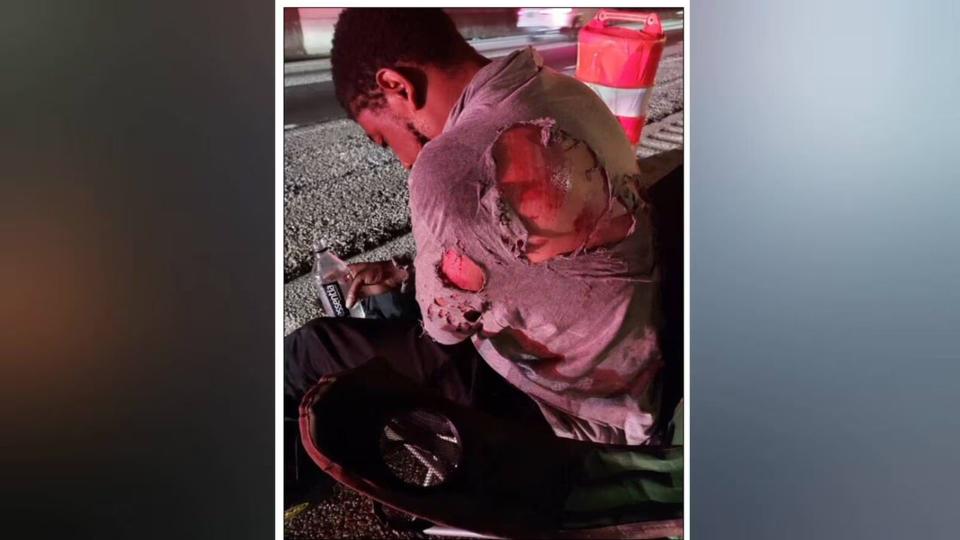 Good Samaritans Rescue Injured Motorcyclist