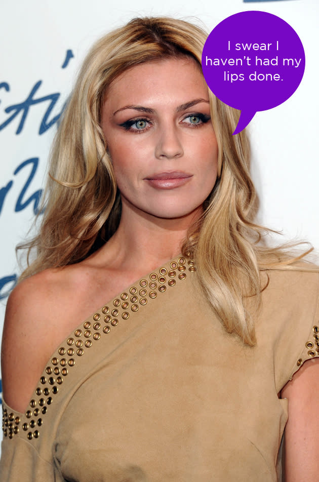 Abbey Clancy dismissed rumours that she's had collagen injections in her lips to plump them up. She tweeted this comment along with the hashtag #foralltheintelligentpeopleoutthere. Well, that told us then.