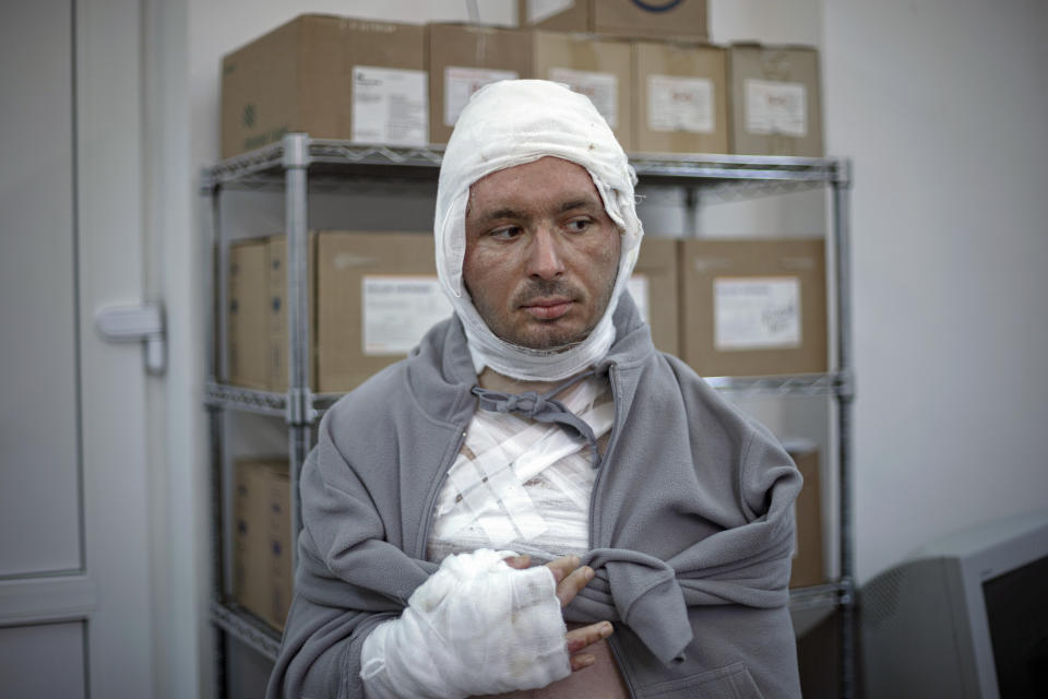 FILE - In this Nov. 24, 2015 file photograph, Miluta Flueras is covered in bandages in a hospital, in Bucharest, Romania, during an interview with the Associated Press, after suffering burns at the Colectiv nightclub in the Romanian capital. The Oscar-nominated Romanian documentary film “Collective” follows a group of journalists delving into the state of health care in the eastern European country in the wake of a deadly 2015 nightclub fire that left dozens of burned victims in need of complex treatment. What they revealed was decades of deep-rooted corruption, a heavily politicized system scarily lacking in care. (AP Photo/Vadim Ghirda, File)