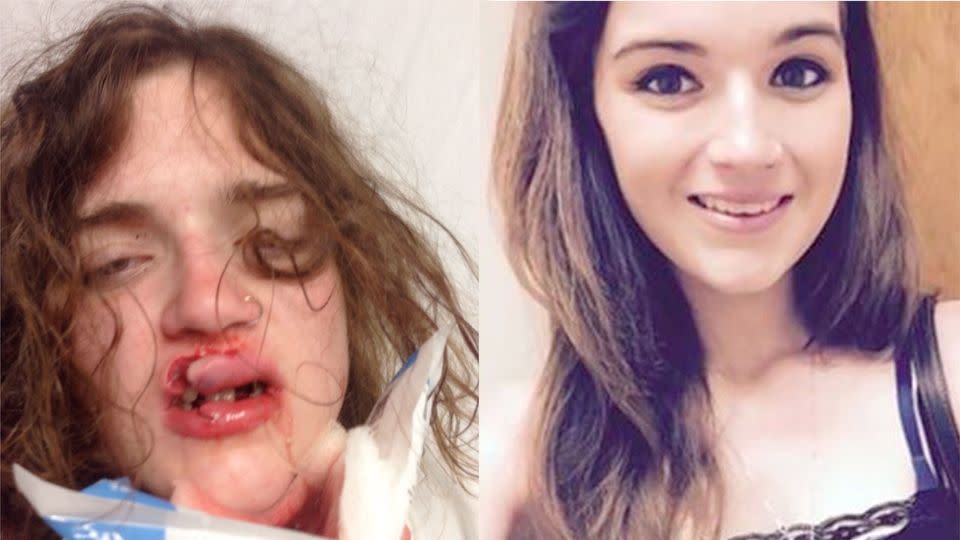 Jessica Byrnes-Laird was attacked by a group of men who later threw a rod through the car window hitting her in the face. Photo: Facebook/GoFundMe