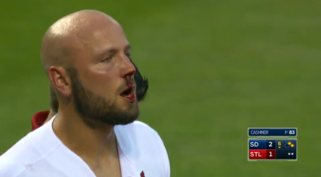 Matt Holliday bloodied by pitch to face in Cardinals' walk-off win