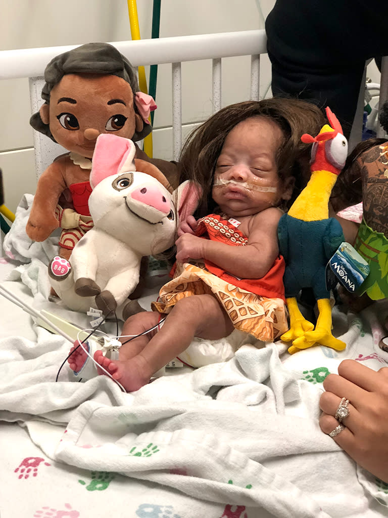 <span>Ulalia made the cutest Moana to match her favorite doll. </span>(Photo: Advocate Children’s Hospital)