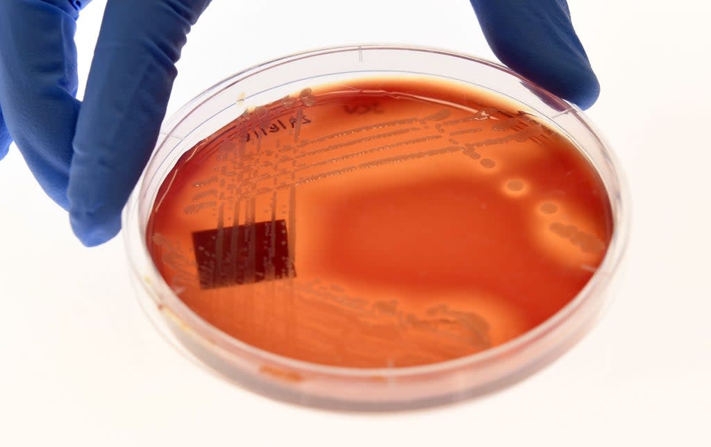 Jean Lee, a PhD student at Melbourne’s Doherty Institute, displays the superbug ‘Staphylcocus epidermidis’ on an agar plate in Melbourne on 4 September 2018 (AFP via Getty Images)