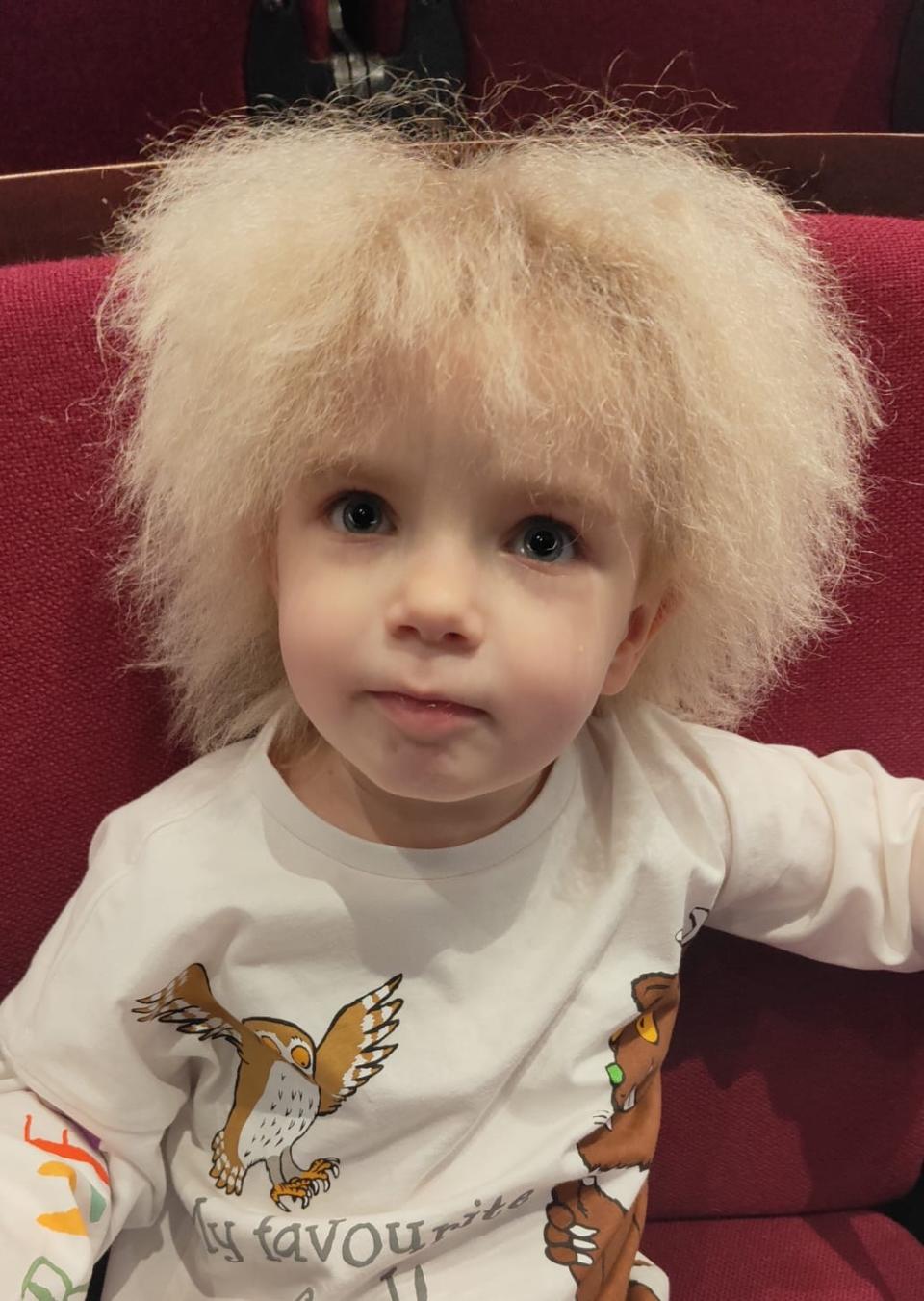 Layla has been diagnosed with uncombable hair syndrome (UHS) - a condition characterised by dry, frizzy hair which defies attempts to tame it.(Charlotte Davis/SWNS)