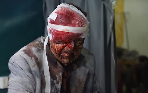 A bandaged injured Syrian man sits on a hospital bed at a make-shift clinic in Zamalka - Credit: AFP