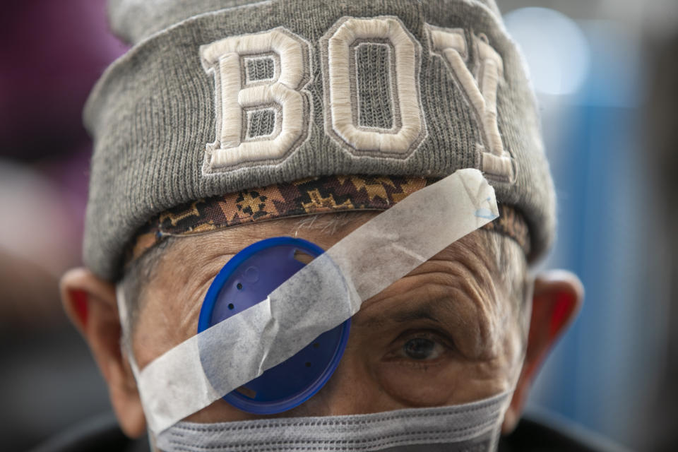 A Nepalese elderly patient waits for his eye patch to be removed at the Tilganga Eye Center in Kathmandu, Nepal, March 26, 2021. Nepal’s “God of Sight” eye doctor renowned for his innovative and inexpensive cataract surgery for the poor is taking his work beyond the Himalayan mountains to other parts of the world so there is no more unnecessary blindness in the world. Dr. Sanduk Ruit, who has won many awards for his work and performed some 130,000 cataract surgery in the past three decades, is aiming to expand his work beyond the borders of his home country and the region to go globally. (AP Photo/Niranjan Shrestha)